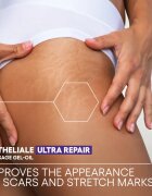 A-Derma Epitheliale A.H. Duo Massage Gel-Oil масажно гел-масло за белези и стрии 40 мл.