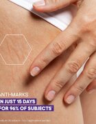 A-Derma Epitheliale A.H. Duo Massage Gel-Oil масажно гел-масло за белези и стрии 40 мл.