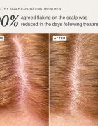 Alpha-H Healthy Scalp ексфолиращ разтвор за глава 100 мл.