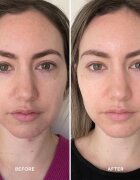 Alpha-H Vitamin B серум за укрепване на кожната бариера 25 мл.