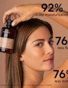 Apivita Dandruff Dry Dandruff Shampoo шампоан против пърхот 250 мл.