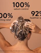 Apivita Dandruff Oily Dandruff Shampoo шампоан против пърхот за мазна коса 250 мл.