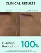 Apivita Just Bee Clear Purifying Cleanser Gel почистващ гел за лице против акне 200 мл.