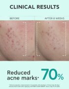 Apivita Just Bee Clear Serum серум за мазна и проблемна кожа 30 мл.