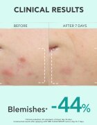Apivita Just Bee Clear Serum серум за мазна и проблемна кожа 30 мл.
