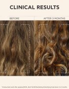 Apivita Royal Jelly Elixir Revitalizing & Densifying Scalp Serum ревитализиращ серум за скалпа 50 мл.
