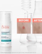 Avene Cleanance Comedomed+ интензивна грижа против несъвършенствата на акнозна кожа 30 мл.