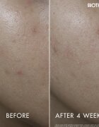 Biotherm Aquasource+ Vitamin Glow Gel гел за лице 30 мл.