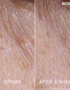 Biotherm Blue Peptides Eyes Lips Contour Reshaper грижа за околоочния контур и устните 15 мл.