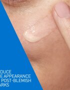 CeraVe Control Cleanser & Retinol Serum Duo цялостна грижа против несъвършенствата на акнозна кожа