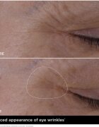 Clarins Double Serum Eye серум против бръчки за околоочната зона с подхранващ ефект 20 мл.