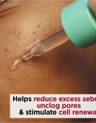 Clarins My Pure-Reset Resurfacing Blemish Serum обновяващ серум за мазна кожа склонна към акне 30 мл.