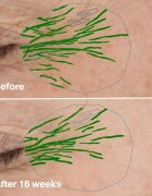 Clinique Smart Clinical™ Repair Wrinke Correcting Serum серум за лице за коригиране на бръчки 50 мл.