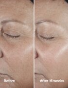 Clinique Smart Clinical™ Repair Wrinke Correcting Serum серум за лице за коригиране на бръчки 50 мл.
