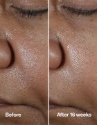 Clinique Smart Clinical™ Repair Wrinke Correcting Serum серум за лице за коригиране на бръчки 50 мл.