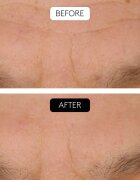 Cocunat Clinical Beauty Filler комплект против стареене на кожата