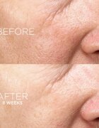 Darphin Intral Inner Youth Rescue Serum успокояващ серум за чувствителна кожа на лицето 50 мл.