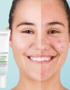 Dermedic Normacne Therapy хидратиращ крем за кожа с акне 40 мл.