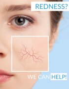 Dermedic Redness Calm коригиращ крем за чувствителна и зачервена кожа SPF 20 40 мл.