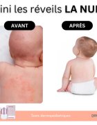 Doucea Doutopia Cream регенериращ крем за атопична кожа при деца и възрастни 50 гр.