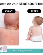 Doucea Doutopia Cream регенериращ крем за атопична кожа при деца и възрастни 50 гр.