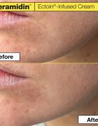 Dr. Jart+ Ceramidin™ Ectoin-Infused Cream хидратиращ крем за лице с церамиди 50 мл.