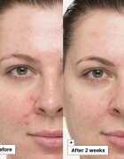 Dr. Jart+ Cicapair™ So Soothing Treatment концентрат за проблемна кожа неутрализиращ зачервяването 30 мл.