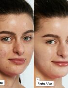 Dr. Jart+ Cicapair™ Tiger Grass Color Correcting Treatment интензивен крем намаляващ зачервяването на кожата 15 мл.