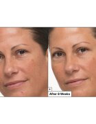 Dr. Jart+ Prejuvenation Cream with Bakuchiol регенериращ и стягащ крем против признаци на стареене 50 мл.