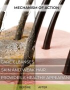 Elfa Pharm Intensive Cosmetic Complex Of 7 Oils 7in1 Shampoo шампоан против косопад 200 мл.