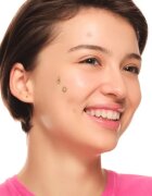 Essence Spot Squad Pimple Patches лепенки за проблемна кожа 32 бр.
