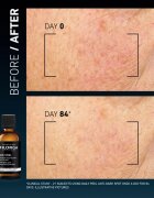 Filorga DAILY PEEL ANTI-DARK SPOT пилинг за лице Против тъмни петна 50 мл.