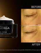 Filorga GLOBAL-REPAIR ADVANCED EYES & LIPS крем против бръчки за контура около очите и устните 15 мл.