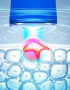 FOREO ESPADA™ 2 писалка със синя светлина за успокояване признаците на акне Cobalt Blue 1 бр.