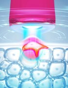 FOREO ESPADA™ 2 писалка със синя светлина за успокояване признаците на акне Fuchsia 1 бр.