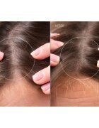 FOREO FAQ™ Scalp Recovery & Thick Hair Probiotic Serum пробиотичен серум за регенерация на косата и скалпа 60 мл.