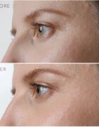 FOREO IRIS™ Firming Eye Serum подмладяващ серум за очи 15 мл.
