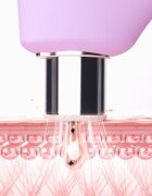 FOREO KIWI™ Derma уред за диамантено микродермабразио и почистване на порите 1 бр.