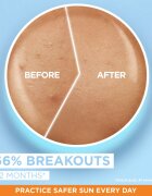 Garnier Ambre Solaire Super UV Niacinamide лек защитен флуид против несъвършенства на кожата SPF 50+ 40 мл.