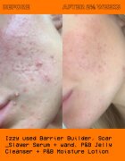 Glow Hub The Scar Slayer озаряващ серум против пигментни петна 30 мл.