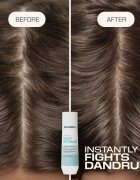 Goldwell Dualsenses Scalp Specialist Anti-Dandruff Shampoo шампоан против пърхот 250 мл.