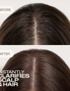 Goldwell Dualsenses Scalp Specialist Clarifying Shampoo дълбоко почистващ шампоан 1000 мл.