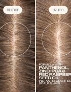 Goldwell Dualsenses Scalp Specialist Clarifying Shampoo дълбоко почистващ шампоан 1000 мл.