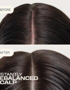 Goldwell Dualsenses Scalp Specialist Rebalance & Hydrate Fluid хидратиращ флуид за възобновяване на скалпа 150 мл.