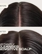 Goldwell Dualsenses Scalp Specialist Sensitive Foam Shampoo шампоан с пяна за чувствителна кожа на скалпа 250 мл.