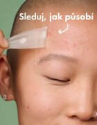 Hero Cosmetics Mighty Patch XL лепенки за проблемна кожа 10 бр.
