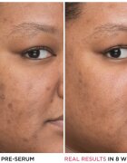 IT Cosmetics Bye Bye Dark Spots изсветляващ серум против пигментни петна с ниацинамид за жени 30 мл.