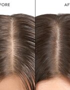 KERASILK Specialists Exfoliating Scalp & Hair Treatment грижа за използване преди нанасянето на шампоан с ексфолиращо действие 200 мл.