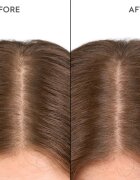 KERASILK Specialists Moisturizing Scalp Drops капки за сух и чувствителен скалп 100 мл.