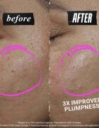 Kiehl's CollaShot Plump Serum колагенов серум за попълване и възстановяване на кожата на лицето за жени 30 мл.